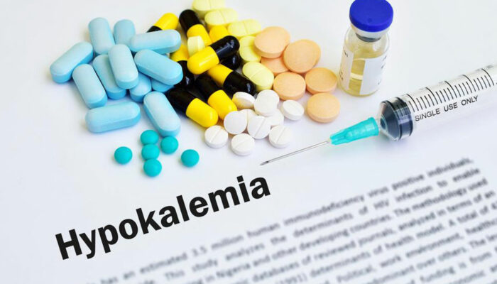 Causes and prevention of Hyperkalemia