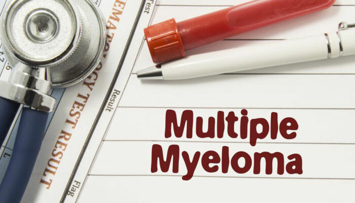 Common types of multiple myeloma and their treatments