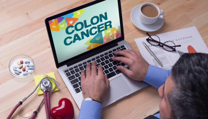 Colon Cancer: Top 3 Signs and Related Symptoms