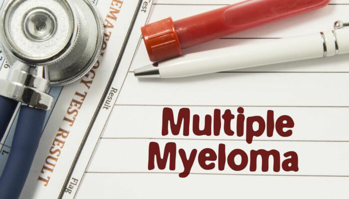 Dealing with multiple myeloma &#8211; Things you should know about