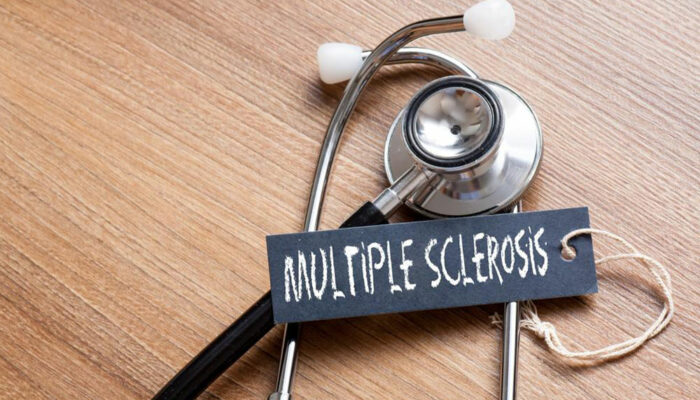 Diagnosis and treatments of multiple sclerosis