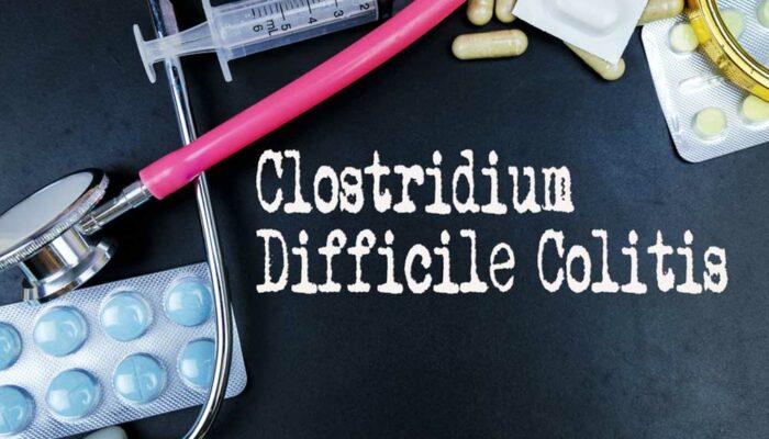 Early Symptoms of Clostridium Difficile Colitis