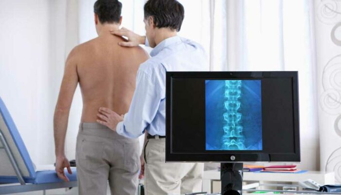 Early Warning Signs of a Spinal Compression Fracture