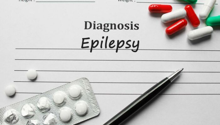 Epilepsy: Causes and Risk Factors