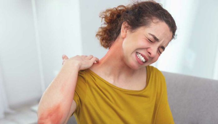 Everything You Need to Know About Shingles Rashes