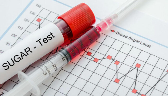 Everything you need to know about blood sugar and its levels