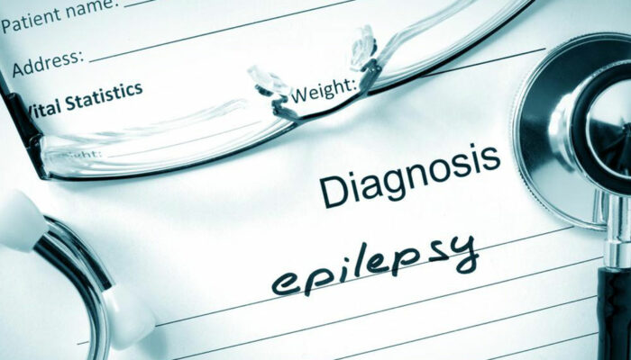 Everything you need to know about epilepsy