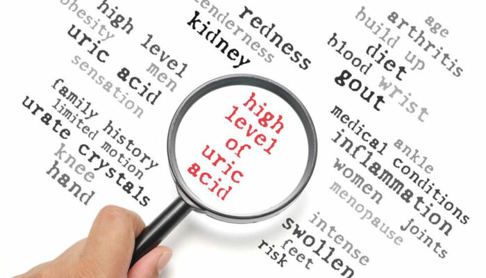 Everything you need to know about high uric acid levels