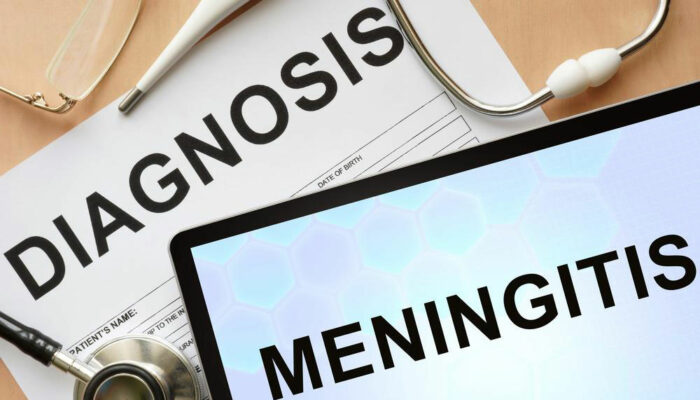 Everything you need to know about meningitis