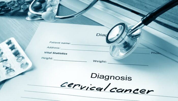 Everything you need to know about the diagnosis and staging of cervical cancer