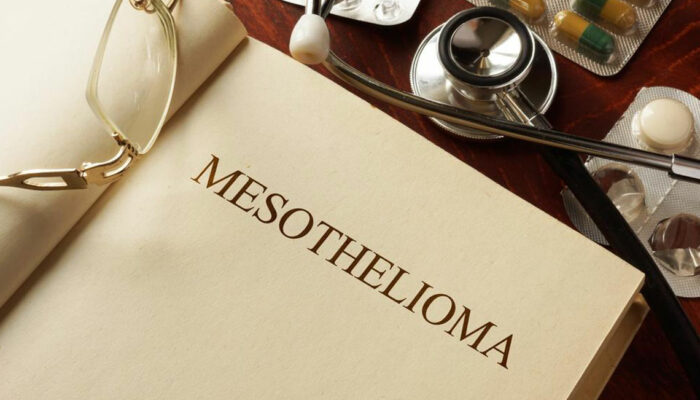 Everything you should know about Mesothelioma