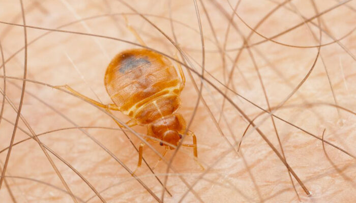 Five tips to keep your home free of bed bugs