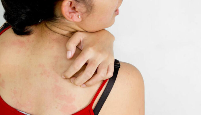 Here are a few common causes of itchy skin