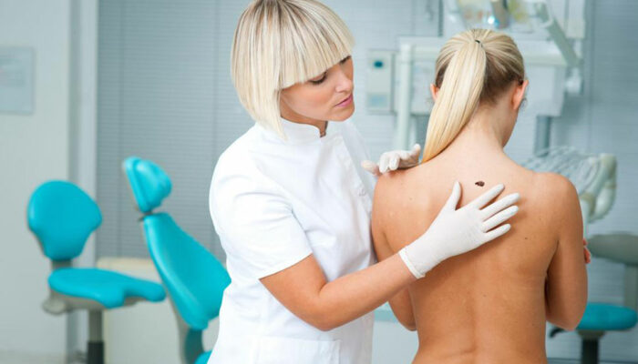 Here are a few common causes and symptoms of melanoma