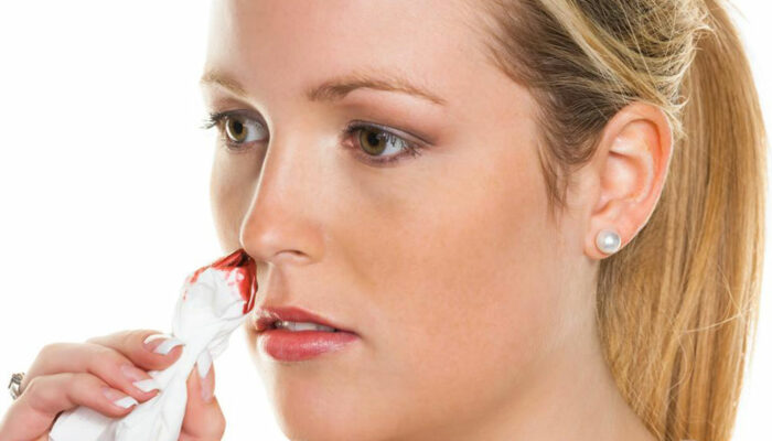 Here are the causes behind nose bleeding