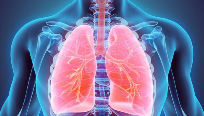 Here is a quick look at the common symptoms and treatments of lung cancer