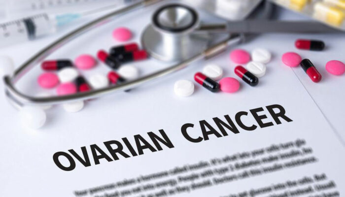 Here’s What You Need to Know about Ovarian Cancer