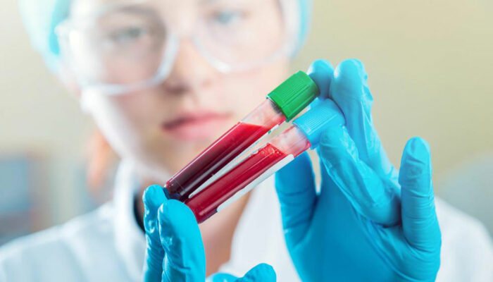 Here&#8217;s why maintaining normal creatinine levels is imperative