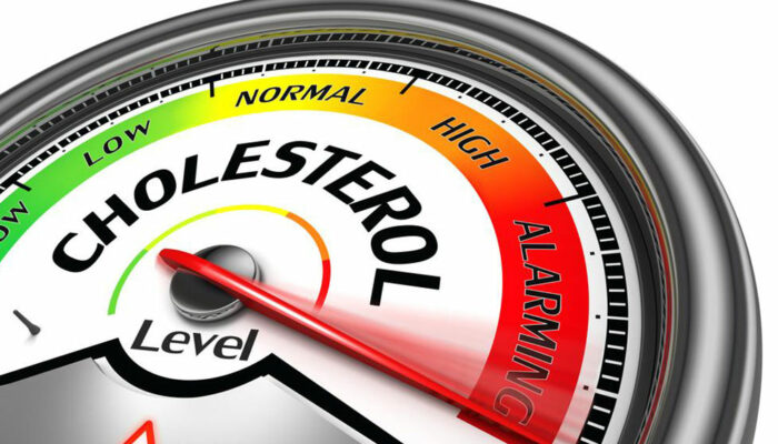 High Cholesterol: Causes and prevention