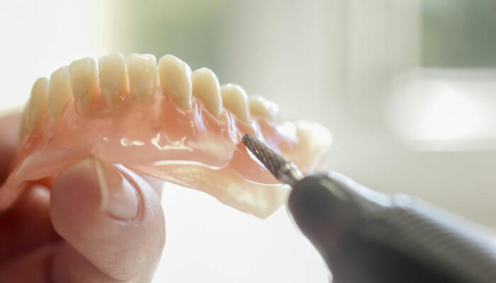 How to keep your lower dentures secure