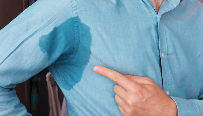 How to tackle excessive sweating