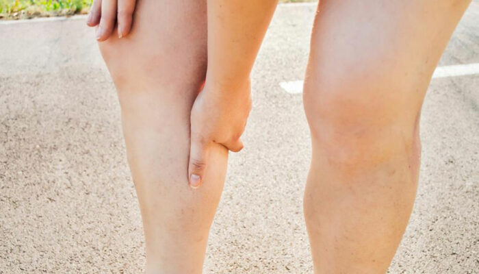 How cholesterol causes leg problems