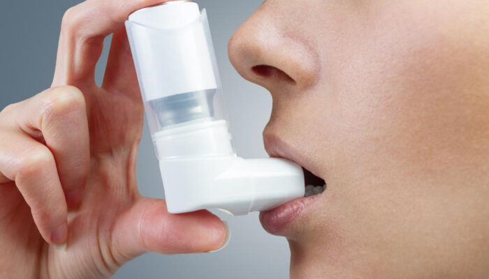 How is severe asthma treated?