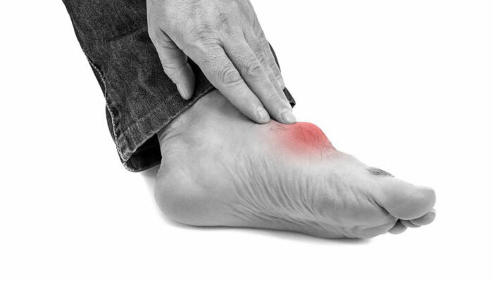 Immediate pain relief measures for gout