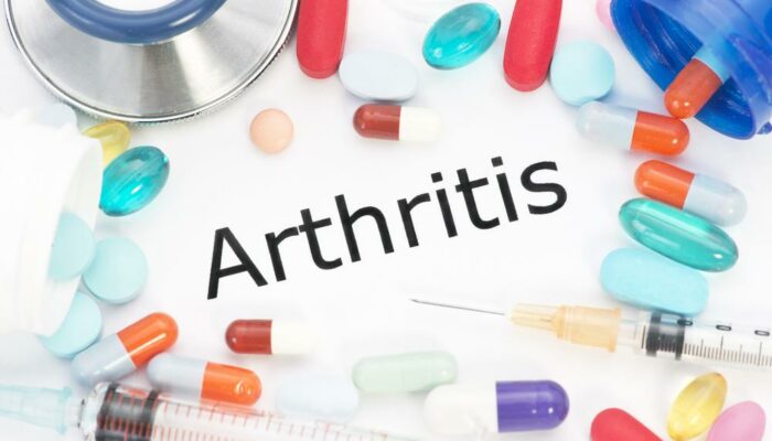 Introduction and Pathology of Osteoarthritis