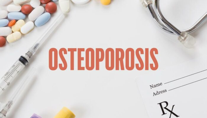 Introduction and Prevalence of Osteoporosis