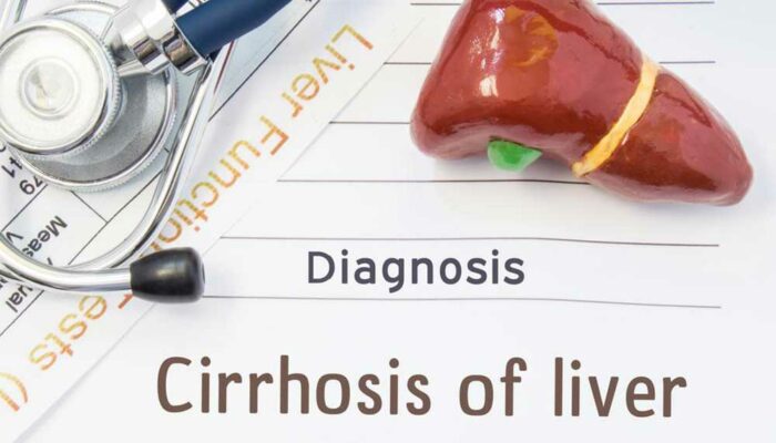 Liver Cirrhosis and its 4 Stages