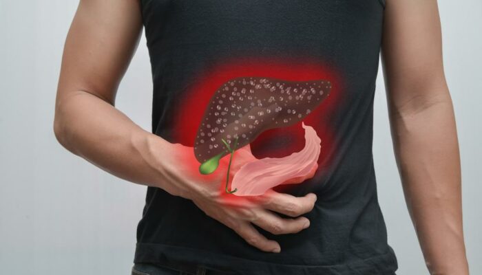 Liver cancer: Causes, symptoms, diagnosis, treatment, and prevention