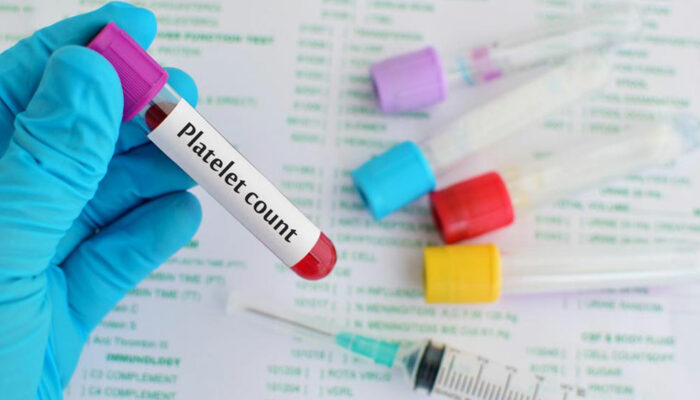 Low platelets count &#8211; Its causes and symptoms