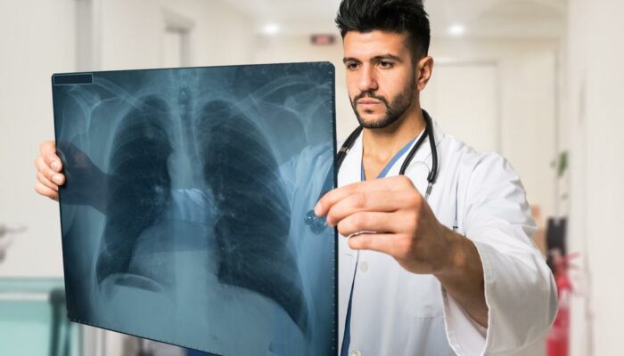 Lung Cancer &#8211; Causes, Symptoms, and Treatment