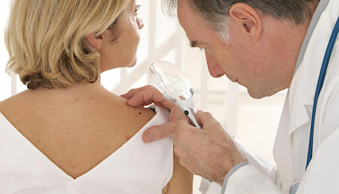 Metastatic malignant melanoma &#8211; types of treatment