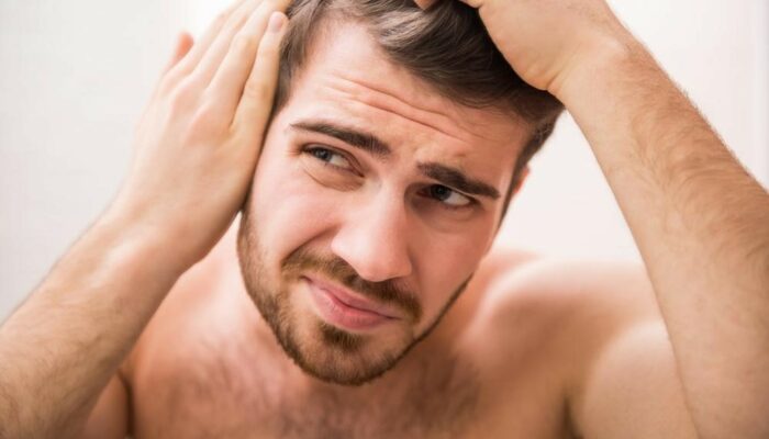 Natural remedies for baldness that you should try