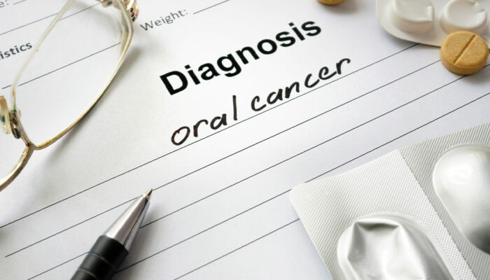 Oral Cancer &#8211; Symptoms, Causes and Management Options