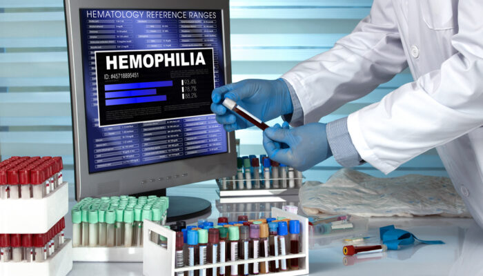 Overview: Hemophilia A and Hemophilia B