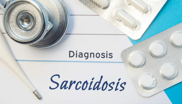 Sarcoidosis risk factors you should know about