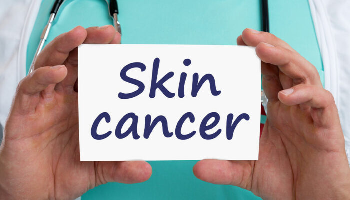 Skin Cancer &#8211; Types, Stages, and More