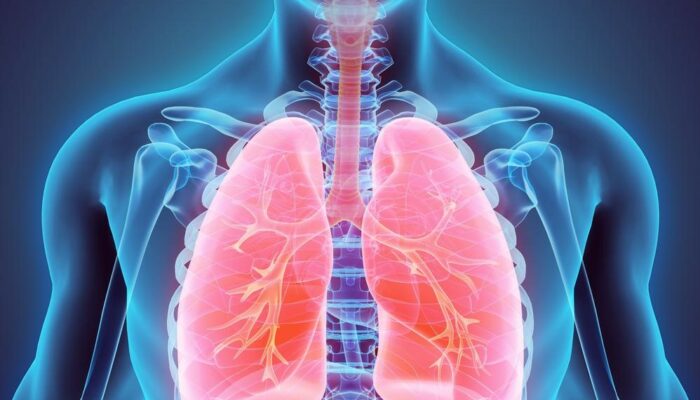 Signs and Symptoms of Lung Cancer