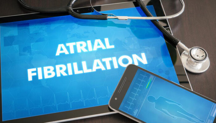 Signs and symptoms of Atrial Fibrillation and how to manage them