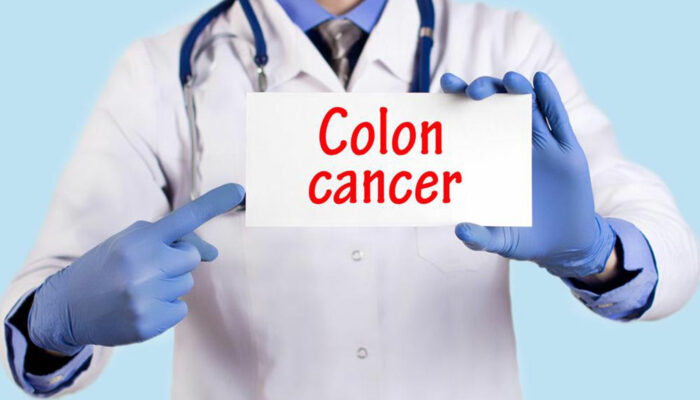 Signs and symptoms of colon cancer