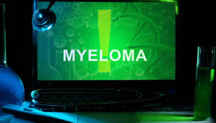 Some facts you should know about relapsed multiple myeloma