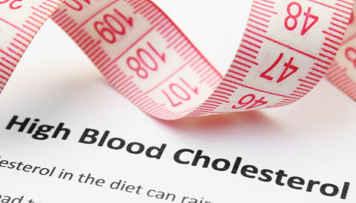 Symptoms, causes, and risks of high cholesterol