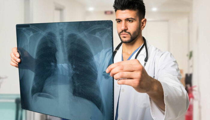 The 3 main signs of lung cancer