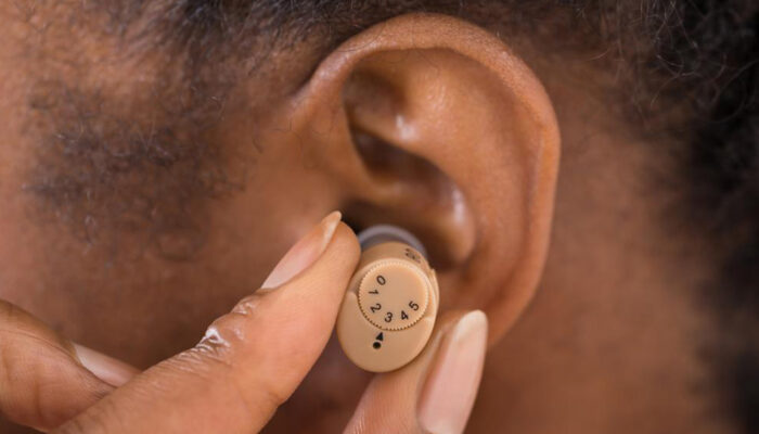 The cost factors for Hearing Aids