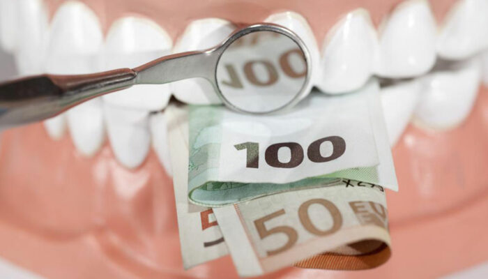 Things to know before buying dentures