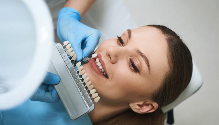 Things to know before opting for dental veneers