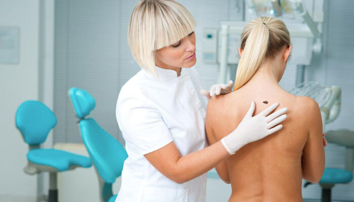 Things you should know about stage four melanoma